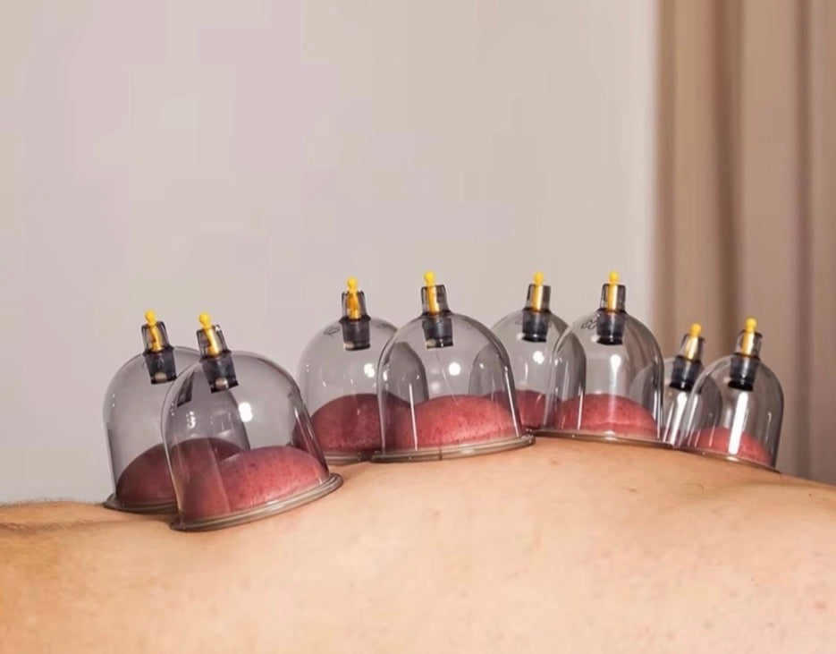 Juego de ventosas, cupping de 12 piezas
